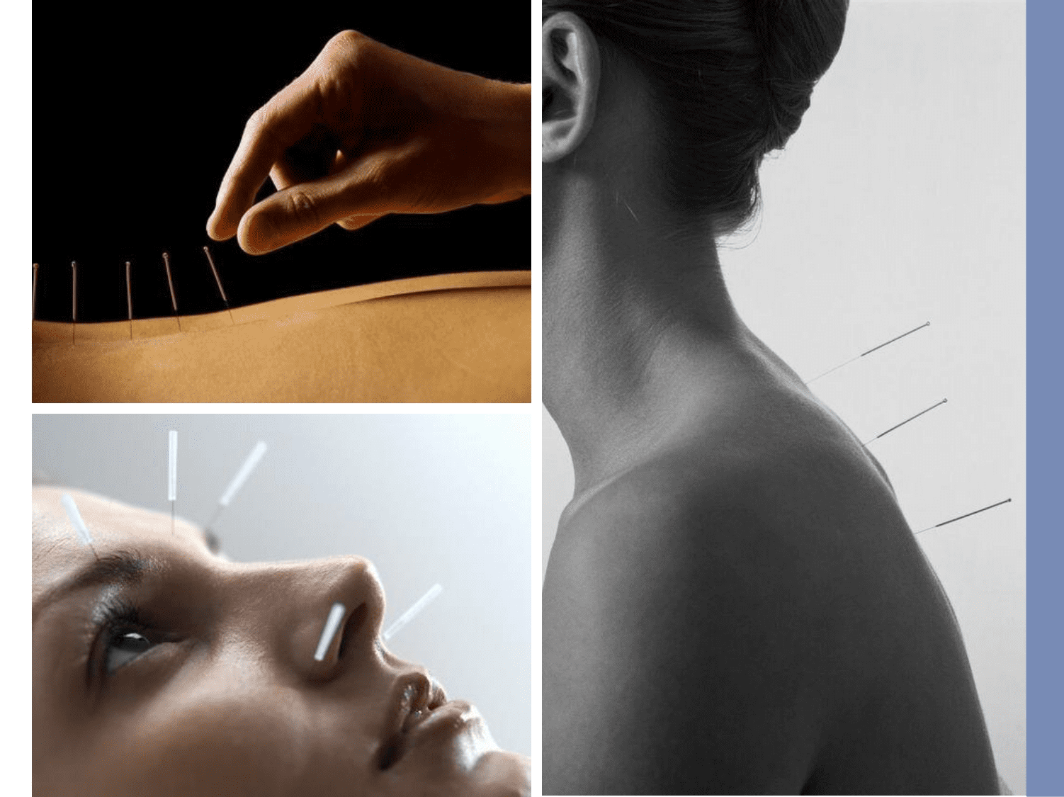 Acupunture Studio amenity image